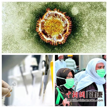 ��������MERS���Б����A������:�ɷ��ɿز��ؿֻ�