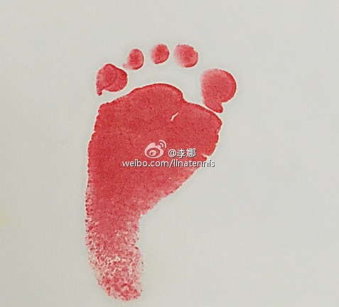 ����΢����������a(ch��n)Ů���҂��ǳ����d