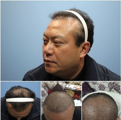 �_���������Q�d�^ֲ�l(f��)����Ƭ��W(w��ng)�ѡ����^��