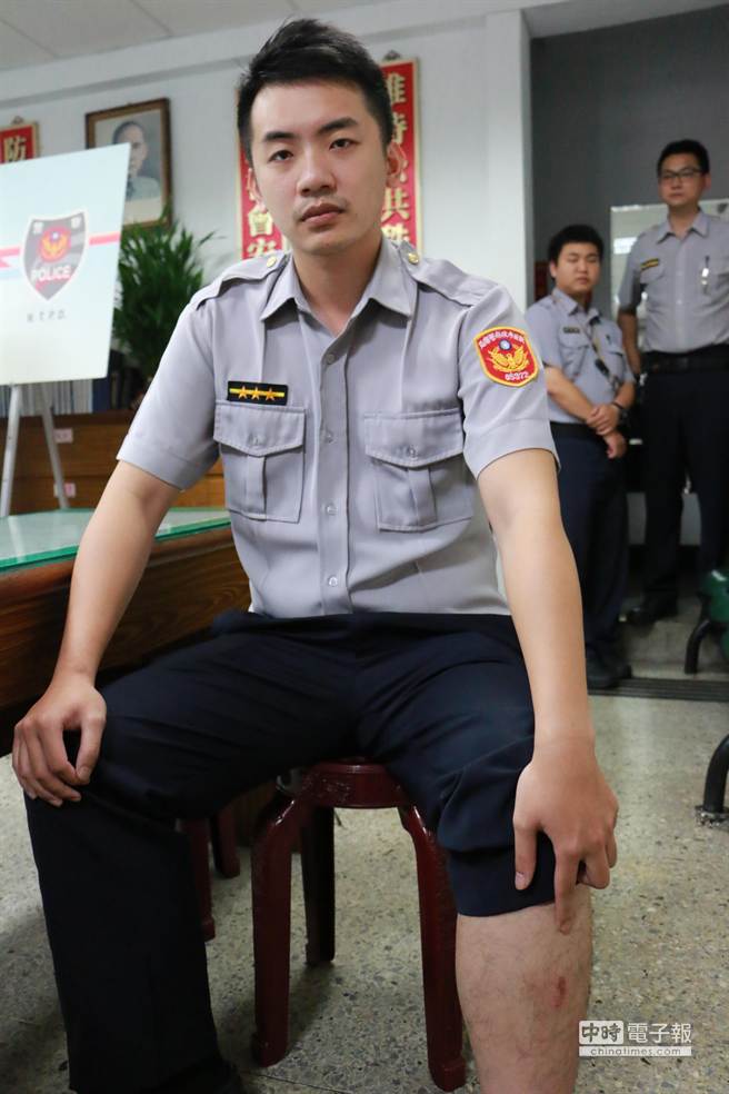 詹書(shū)瑋左小腿留下明顯傷痕。(中時(shí)電子報(bào)圖 孟祥杰攝) 詹書(shū)瑋左小腿留下明顯傷痕。(中時(shí)電子報(bào)圖 孟祥杰攝)