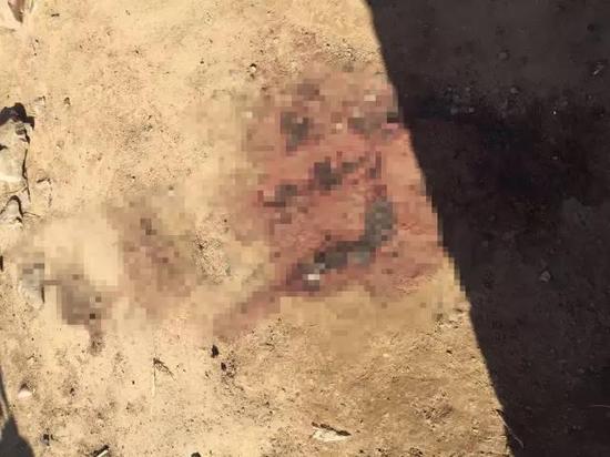 �T������д���Ѫ�E