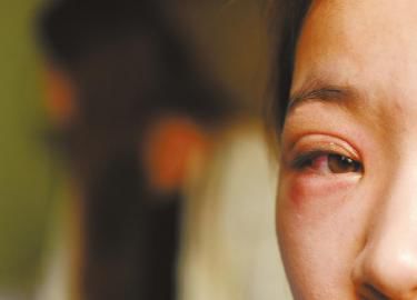 ëë��һֻ�۾��܂��t�[��