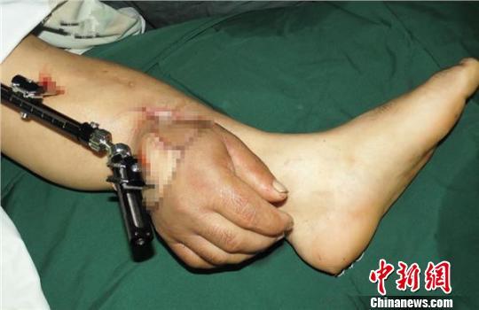 ���Ӕ��֡����B��С�� 30�����ɹ��ƻظ첲