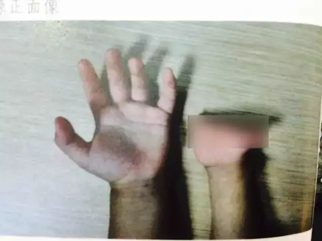 �ЋD��ήa�z�����´�����Ů�� �Ҍ�Ҫ���tԺ��؟