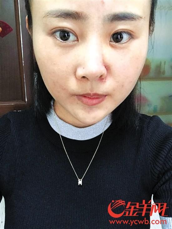 受害人被打前后對比 (圖片由當事人提供)