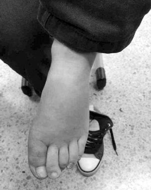 �Ͼ���Ű����ͯ�Q�����e���򲻹��^ĸ